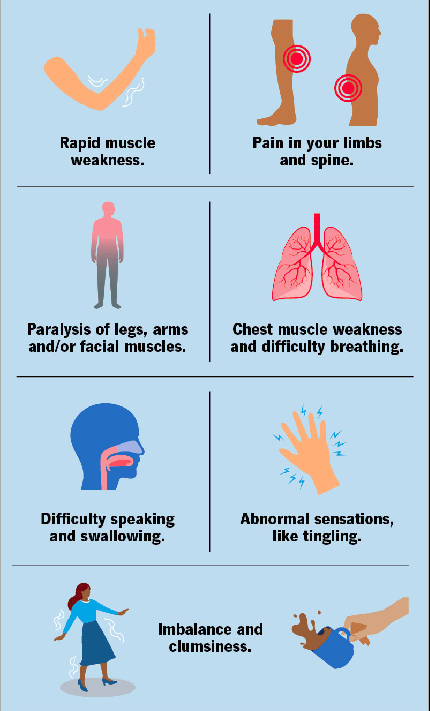 GBS VIRUS (Guillain-Barré Syndrome) - TheBlinkTech